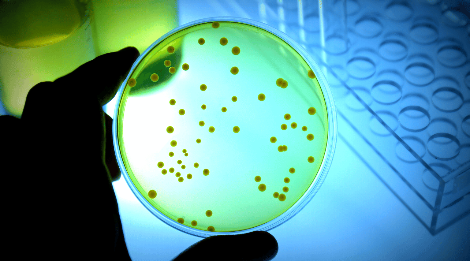 Understanding Bacterial Endotoxins Method Validations: A Crucial Step in Pharmaceutical Safety
